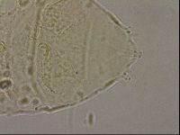 Echiniscus merokensis image