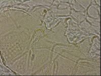 Echiniscus merokensis image