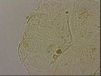 Echiniscus merokensis image