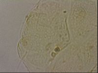 Echiniscus merokensis image