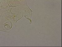 Echiniscus merokensis image