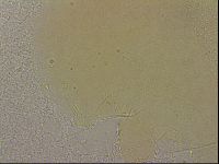 Echiniscus merokensis image