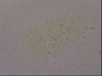 Echiniscus merokensis image