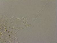 Echiniscus merokensis image