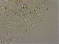 Echiniscus merokensis image
