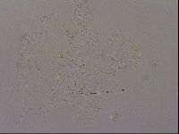 Echiniscus merokensis image