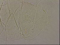 Echiniscus merokensis image