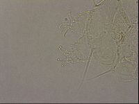 Echiniscus merokensis image