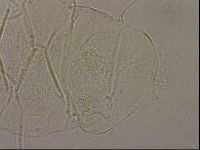 Echiniscus merokensis image