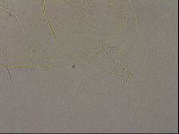 Echiniscus merokensis image