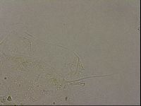 Echiniscus merokensis image