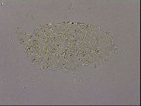 Echiniscus merokensis image