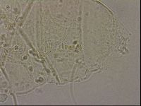 Echiniscus merokensis image