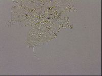 Echiniscus merokensis image