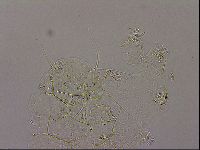 Echiniscus merokensis image