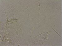 Echiniscus merokensis image