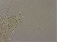 Echiniscus merokensis image