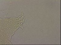 Echiniscus merokensis image