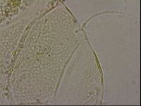 Echiniscus merokensis image