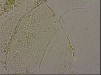 Echiniscus merokensis image