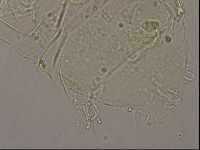 Echiniscus merokensis image