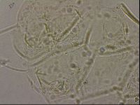 Echiniscus merokensis image
