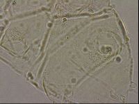 Echiniscus merokensis image