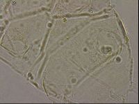 Echiniscus merokensis image