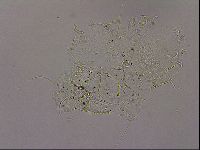 Echiniscus merokensis image