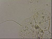 Echiniscus merokensis image