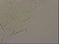 Echiniscus merokensis image