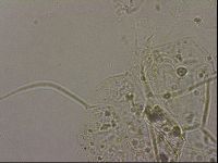 Echiniscus merokensis image