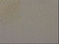 Echiniscus merokensis image