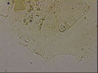 Echiniscus merokensis image