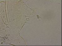 Echiniscus merokensis image