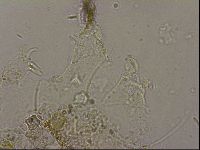 Echiniscus merokensis image