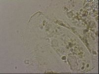 Echiniscus merokensis image