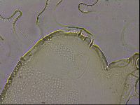Echiniscus merokensis suecicus image