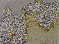 Echiniscus militaris image