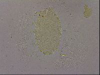 Echiniscus militaris image