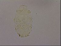 Echiniscus nigripustulus image