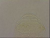 Echiniscus nigripustulus image