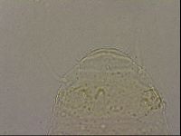 Echiniscus nigripustulus image