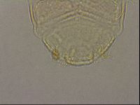 Echiniscus nigripustulus image