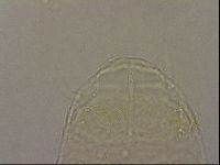 Echiniscus nigripustulus image