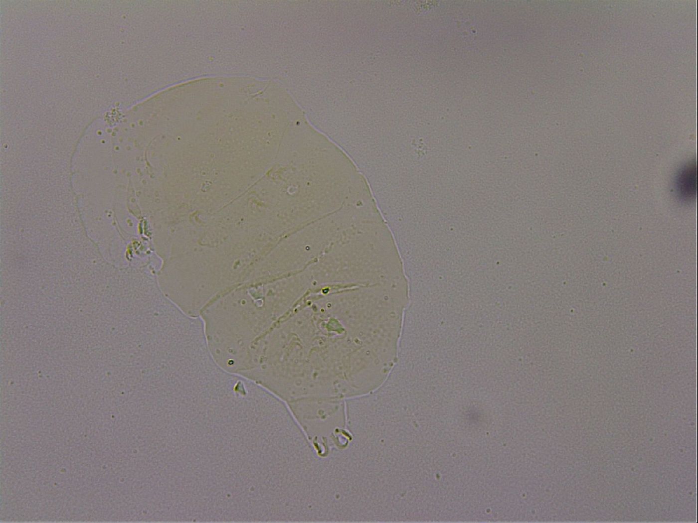 Echiniscus nigripustulus image