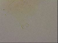 Echiniscus nigripustulus image
