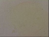 Echiniscus nigripustulus image
