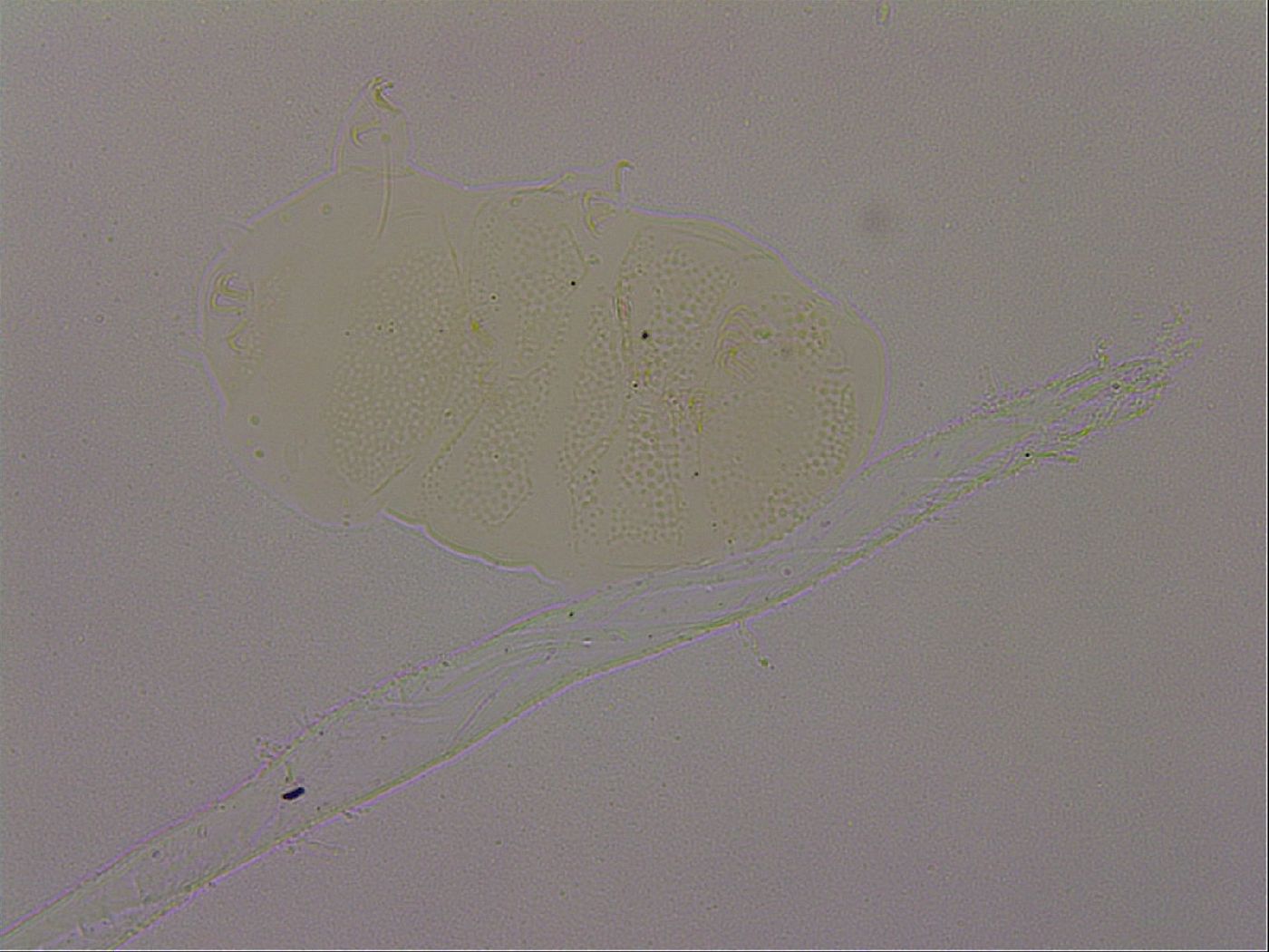 Echiniscus nigripustulus image