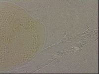 Echiniscus nigripustulus image